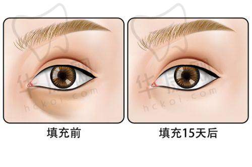 西安西美医院可以做直腿术吗?