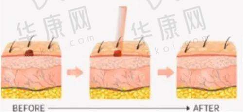总结：东莞东城紫芯医疗美容门诊部的优势
