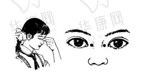 个性化飞秒手术前检查