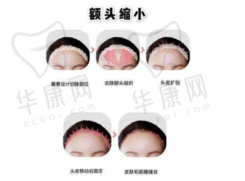 吴紫权医生预约方式