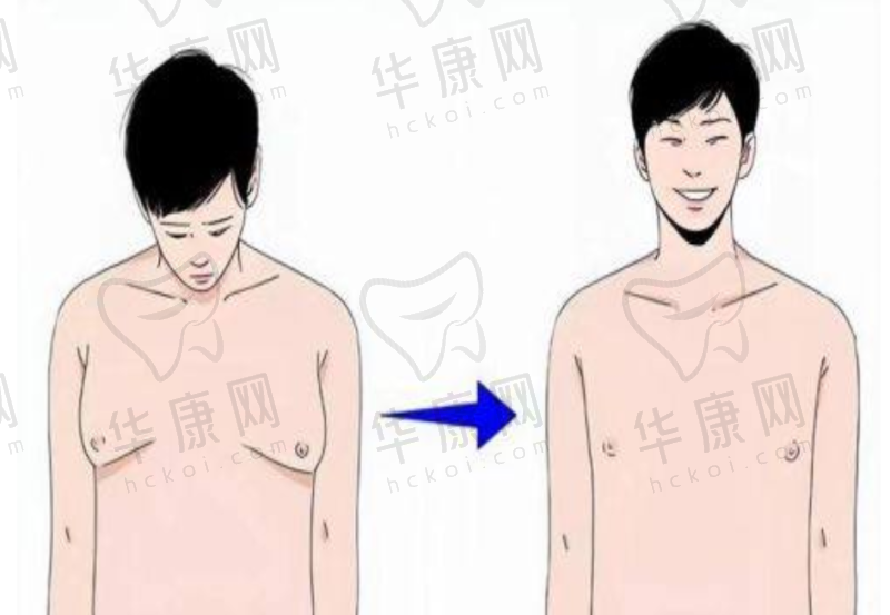 哪些因素影响处女膜修复术后首次同房见血情况?