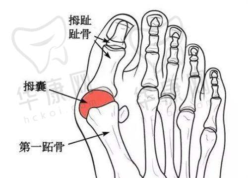 深圳后海安美聚光医疗美容彭喜医生在吸脂项目的特色优势