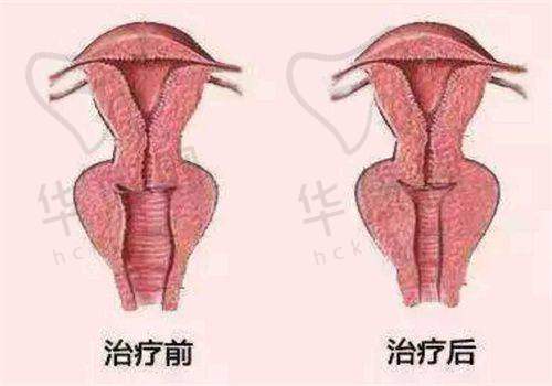 贵阳美莱医疗美容医院预约挂号流程