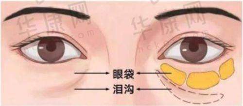 深圳鹏程医院疤痕科有哪些可靠的治疗设备？