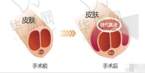 深圳注射除皱医院价格表