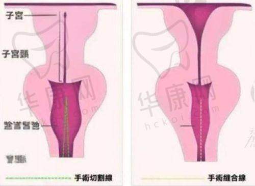 深圳画美医疗美容医院陈贞宜医生特色技术优势