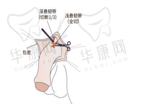 成都美莱整形医院是正规的吗？正规资质齐全技术优，口碑良好值得信赖