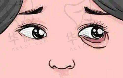 成都九龙医院私密整形科孙梅女膜修复的技术优势
