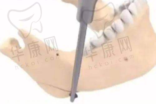 上海伊莱美医疗美容医院怎么样？医院的详细介绍