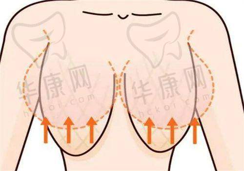 南宁爱思特整形医院磨骨医生