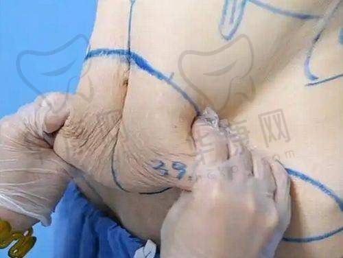 朱星蓉医生特色技术优势