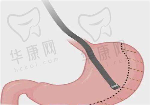 南宁爱思特整形的服务与环境口碑