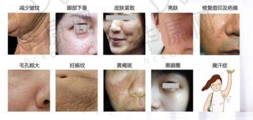 选对医生和护理方法能否避免留疤呢?