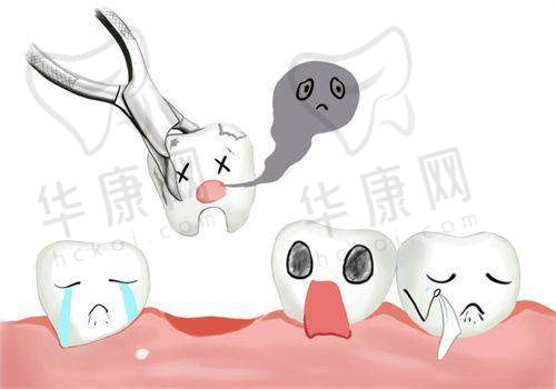 雅安优诺口腔在拔牙项目上的医院优势