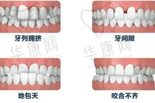 襄阳时代永恒口腔儿童早期干预矫正的技术特色