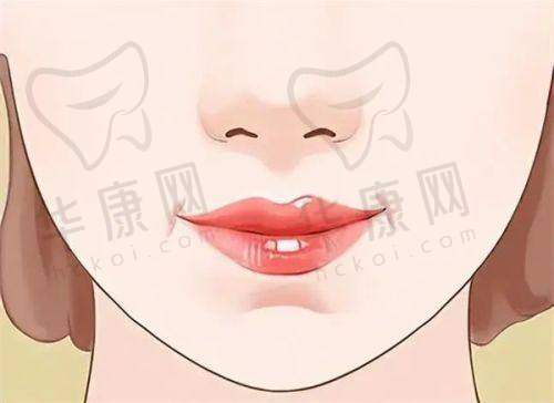 哪些因素加剧了修复难度?