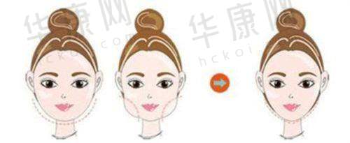贵阳美莱医疗美容医院详细介绍