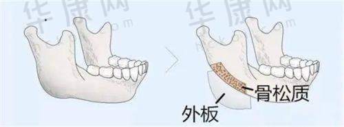 深圳八大处医疗美容医院祁峰医生预约方式