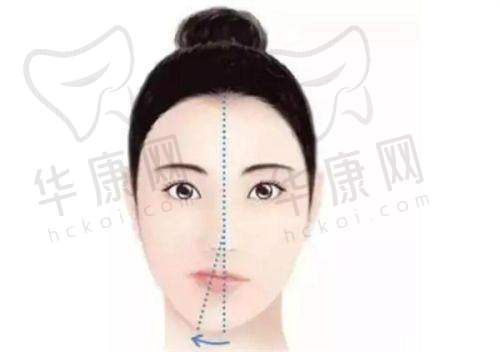 成都现代医疗美容医院及李献和医生唇裂二期修复手术流程是怎样的？