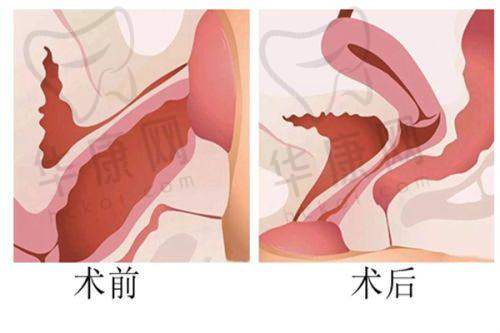成都东篱医院整形外科的技术与设备优势