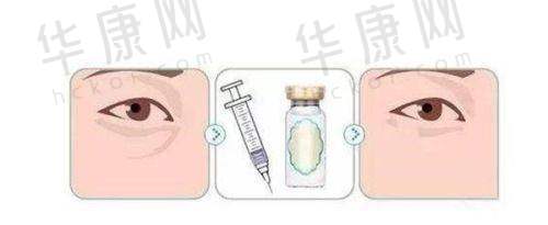 成都九龙医院私密整形科孙梅阴道紧缩手术的预约指南