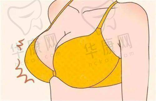 南宁爱思特整形医院磨骨价格与服务