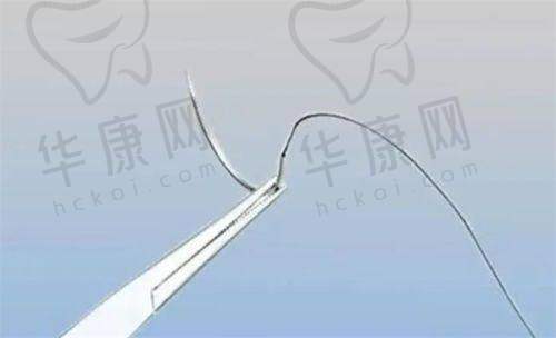 手术过程