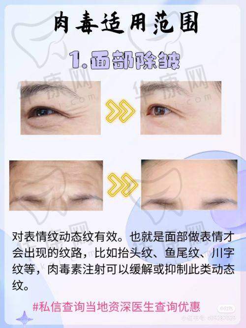 北京樱桃医疗美容诊所正规吗？