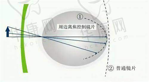 成都普瑞眼科医院