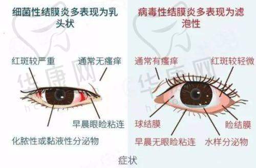 周口中视眼科医院的设备与技术优势