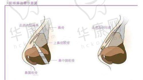 福州鼓楼爱美尔医疗美容刘真俊擅长项目