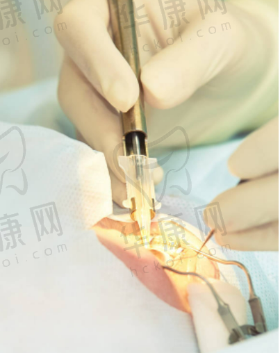 郑州视光眼科医院近视手术好的医生有哪些?