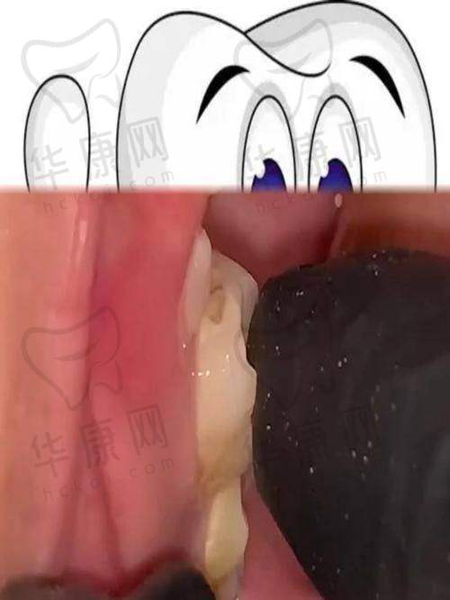运城运中口腔医院的地理位置与预约方式
