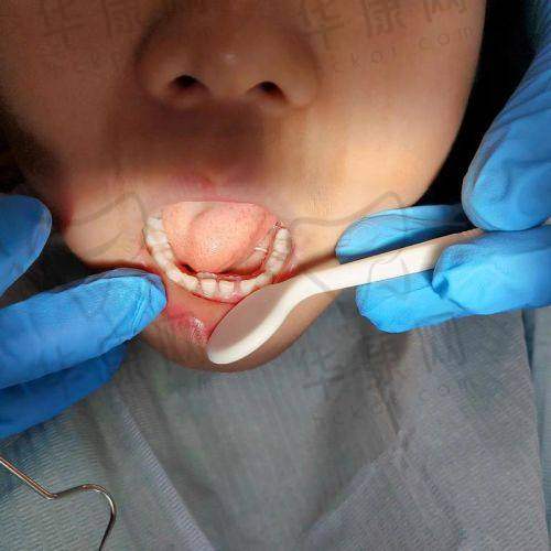 运城运中口腔医院在乳牙拔除项目的特色优势
