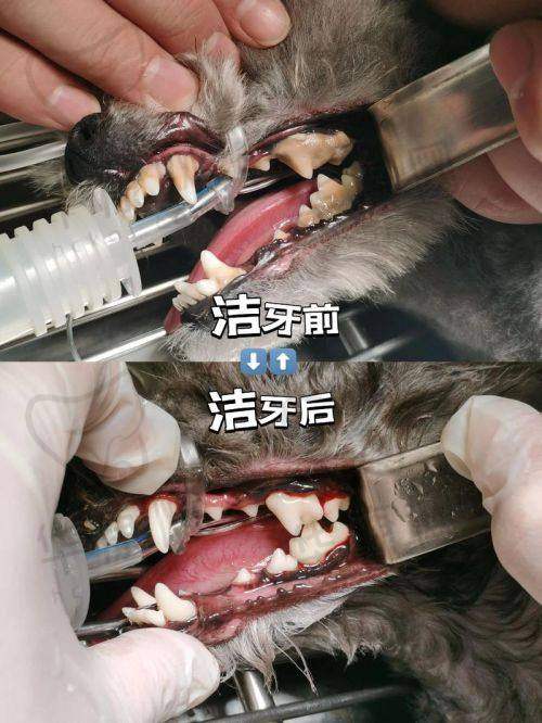 宜春袁州施美尔口腔在超声波洁牙方面的医院优势