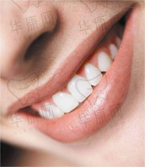 金华兰溪华博仕口腔美国皓得适美白仅580元起，口碑佳技术优值得信赖