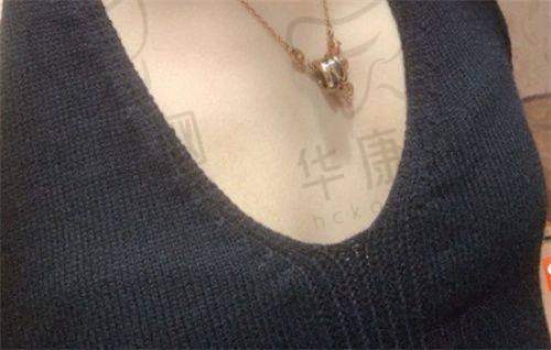 朱继锋医生特色技术优势