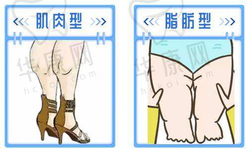李朕做自体脂肪隆胸价格49000元起,这个价格值得吗?