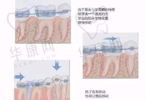 刘远程无痕筋膜提升适合人群