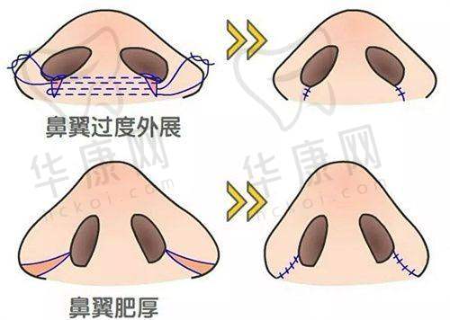 重庆当代整形外科医院安可忍医生预约方式