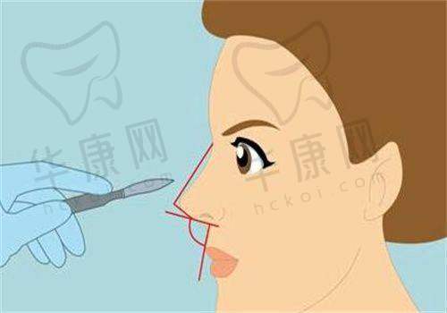 深圳今喜医疗美容门诊部正规吗？