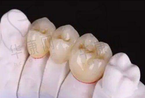 大理美伢口腔的医生看牙技术真的出名靠谱吗？