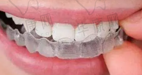 4. 安顺华美口腔