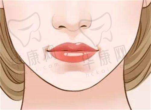 大连沙医生整形做双眼皮医生技术特点对比