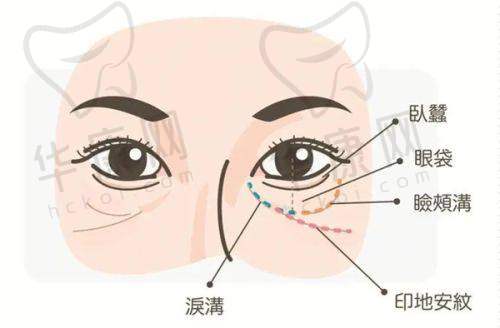 美莱整形超声炮有成功实例吗?