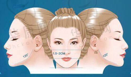 大连沙医生整形做双眼皮医生推荐