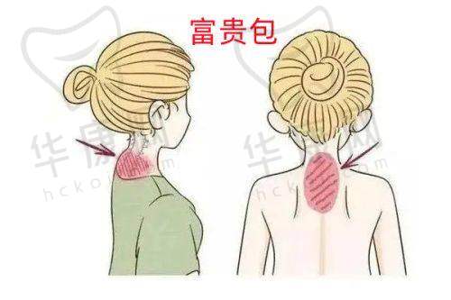杭州连天美医疗美容医院