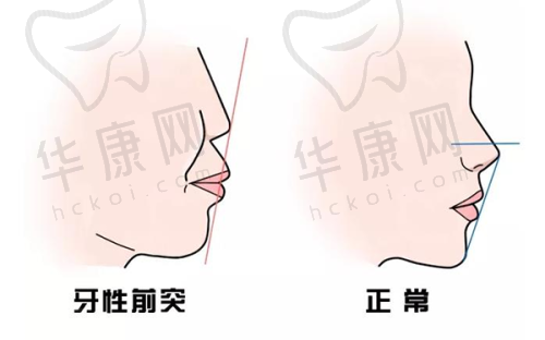 四川友谊医院整形美容科怎么样是三甲吗？口碑良好效果显著价格待询！