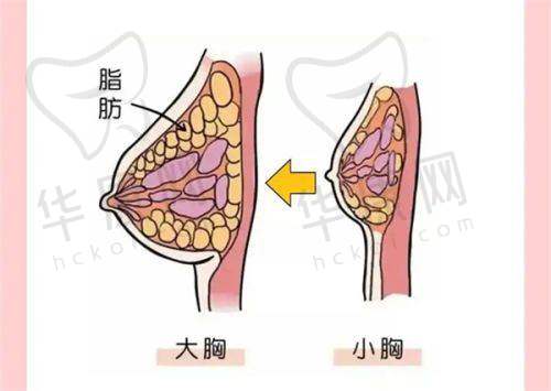 面部微整注射的成效呈现