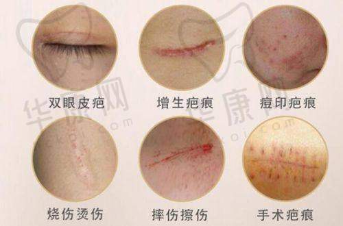 西安壹加壹医疗美容医院傲诺拉星熠隆胸的品牌优势